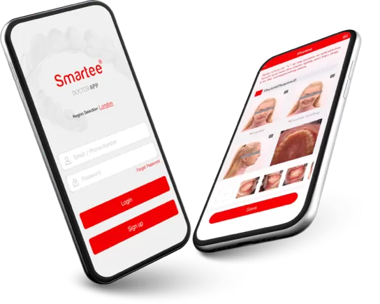 Laden Sie die App herunter