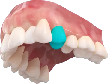 Tag-Aligner