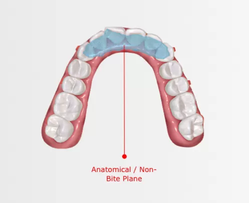 Unterkiefer-Neu position ierungs gerät mit Biss ebene