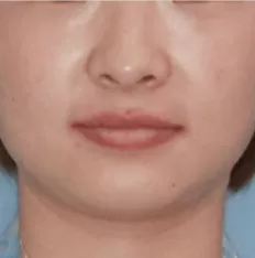 Gesichtsfotos vor der Behandlung