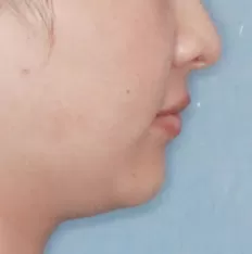 Gesichtsfotos vor der Behandlung