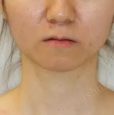 Gesichts fotos vor der Behandlung