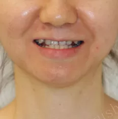 Gesichts fotos vor der Behandlung