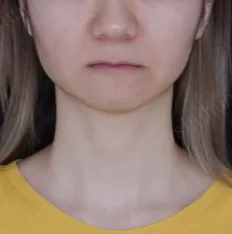Gesichts fotos vor der Behandlung