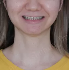 Gesichts fotos vor der Behandlung