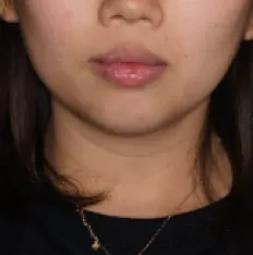 Gesichts fotos vor der Behandlung