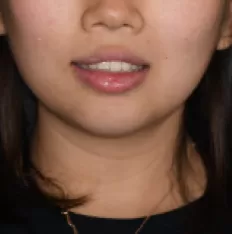 Gesichts fotos vor der Behandlung