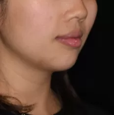 Gesichts fotos vor der Behandlung