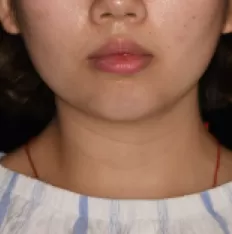 Gesichts fotos vor der Behandlung