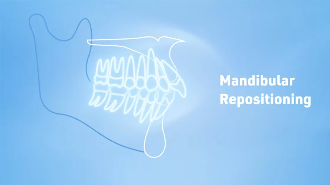 Wie funktioniert es?