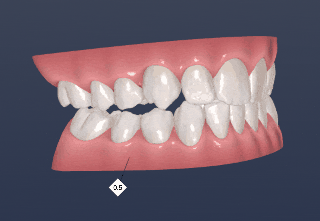 Phase 2 (Kieferorthopädie)