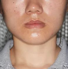 Gesichts fotos vor der Behandlung