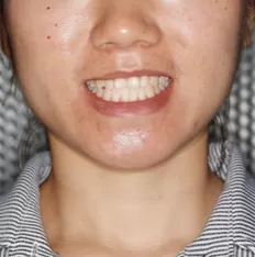 Gesichts fotos vor der Behandlung