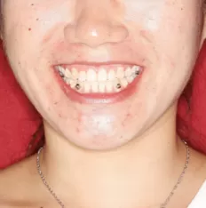 Gesichts fotos vor der Behandlung