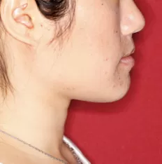 Gesichts fotos vor der Behandlung