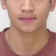 Gesichts fotos vor der Behandlung