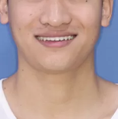 Gesichts fotos vor der Behandlung