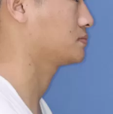 Gesichts fotos vor der Behandlung