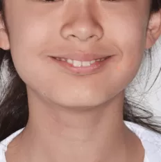 Gesichts fotos vor der Behandlung