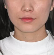 Gesichts fotos vor der Behandlung