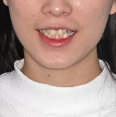 Gesichts fotos vor der Behandlung