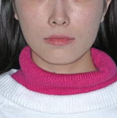 Gesichts fotos vor der Behandlung