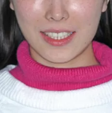 Gesichts fotos vor der Behandlung