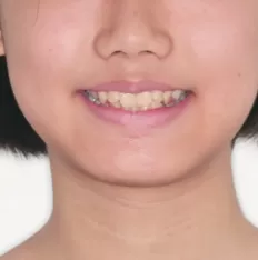 Gesichtsfotos vor der Behandlung