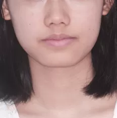 Gesichtsfotos vor der Behandlung