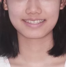 Gesichtsfotos vor der Behandlung
