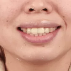 Gesichtsfotos vor der Behandlung
