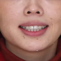 Gesichtsfotos vor der Behandlung