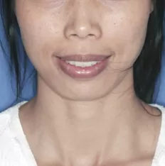 Gesichtsfotos vor der Behandlung