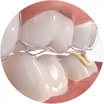 Interaktive Elastiken